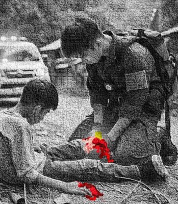 Injured boy with young man attempting to stop the bleeding.